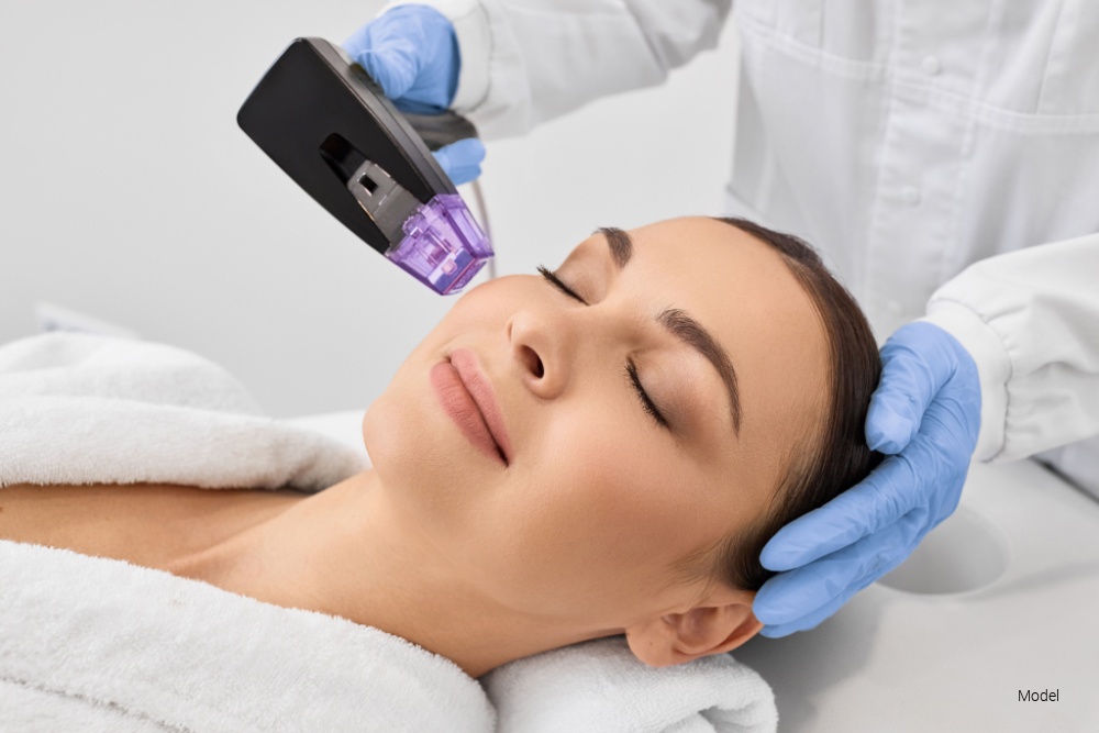 RF Microneedling