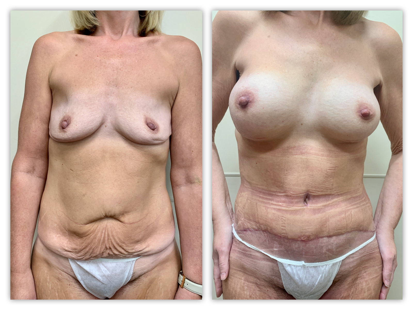 Before and After Image