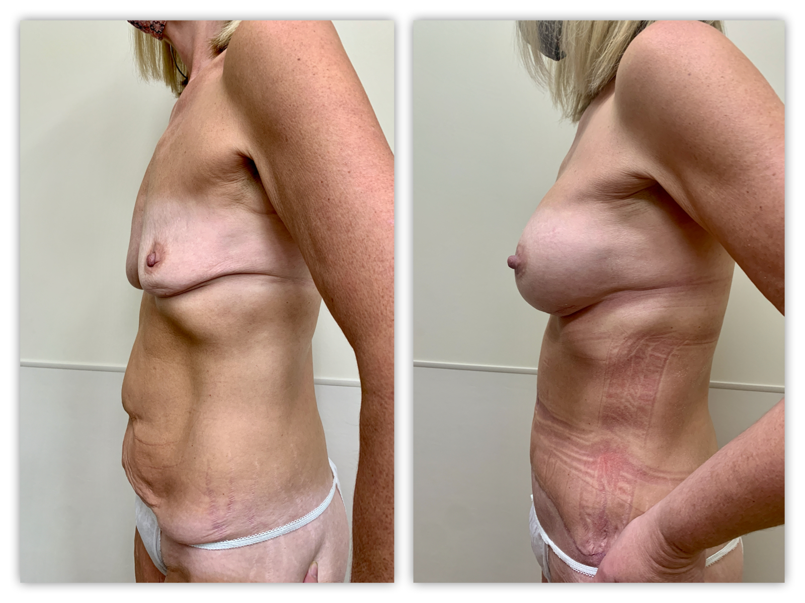 Before and After Image