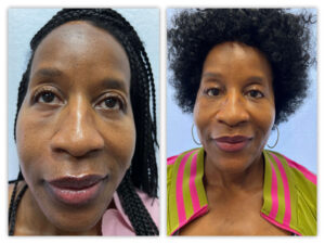 Before and After Image