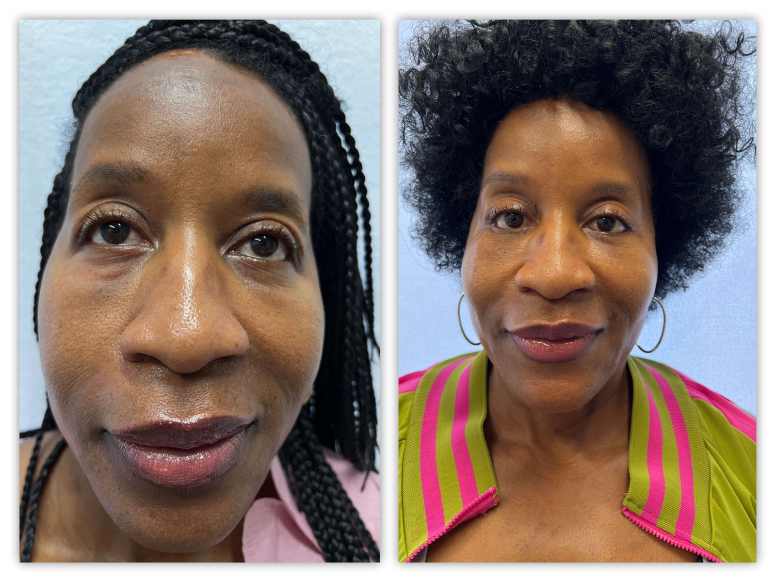 Before and After Image