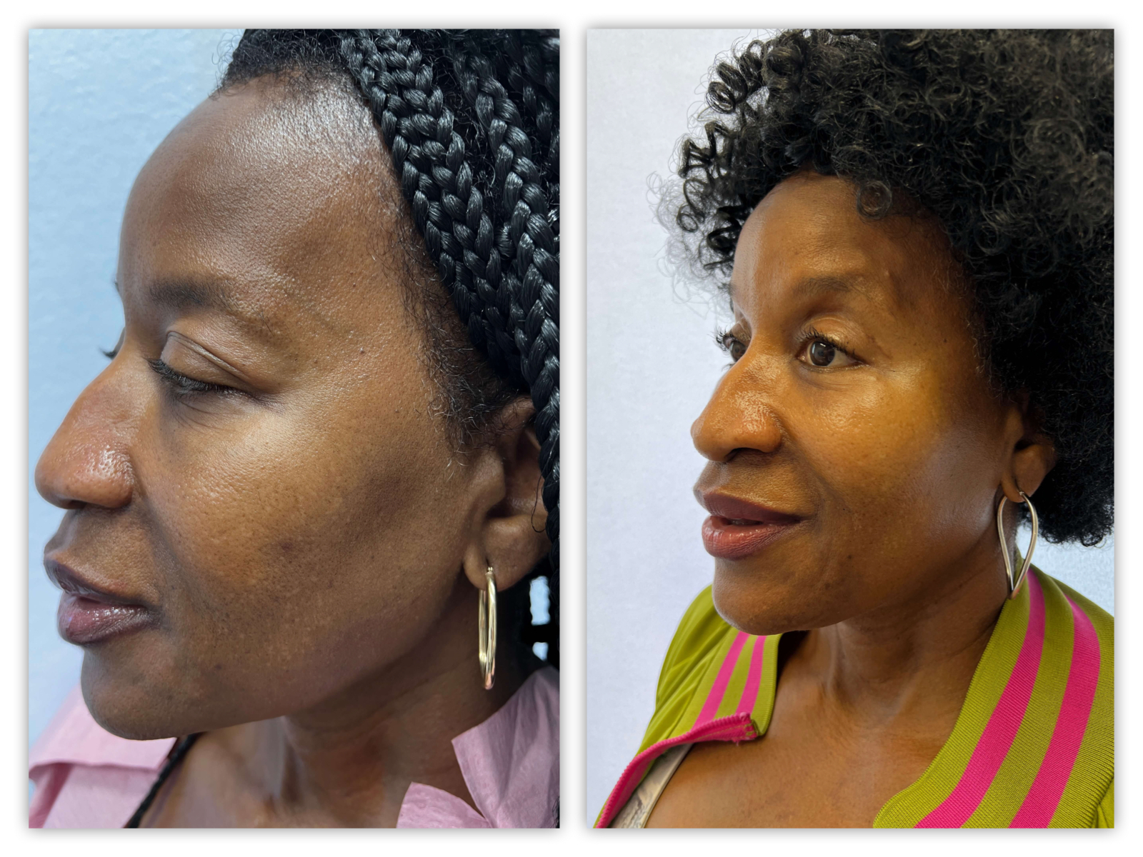 Before and After Image