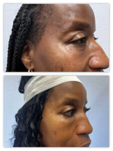 Before and After Image