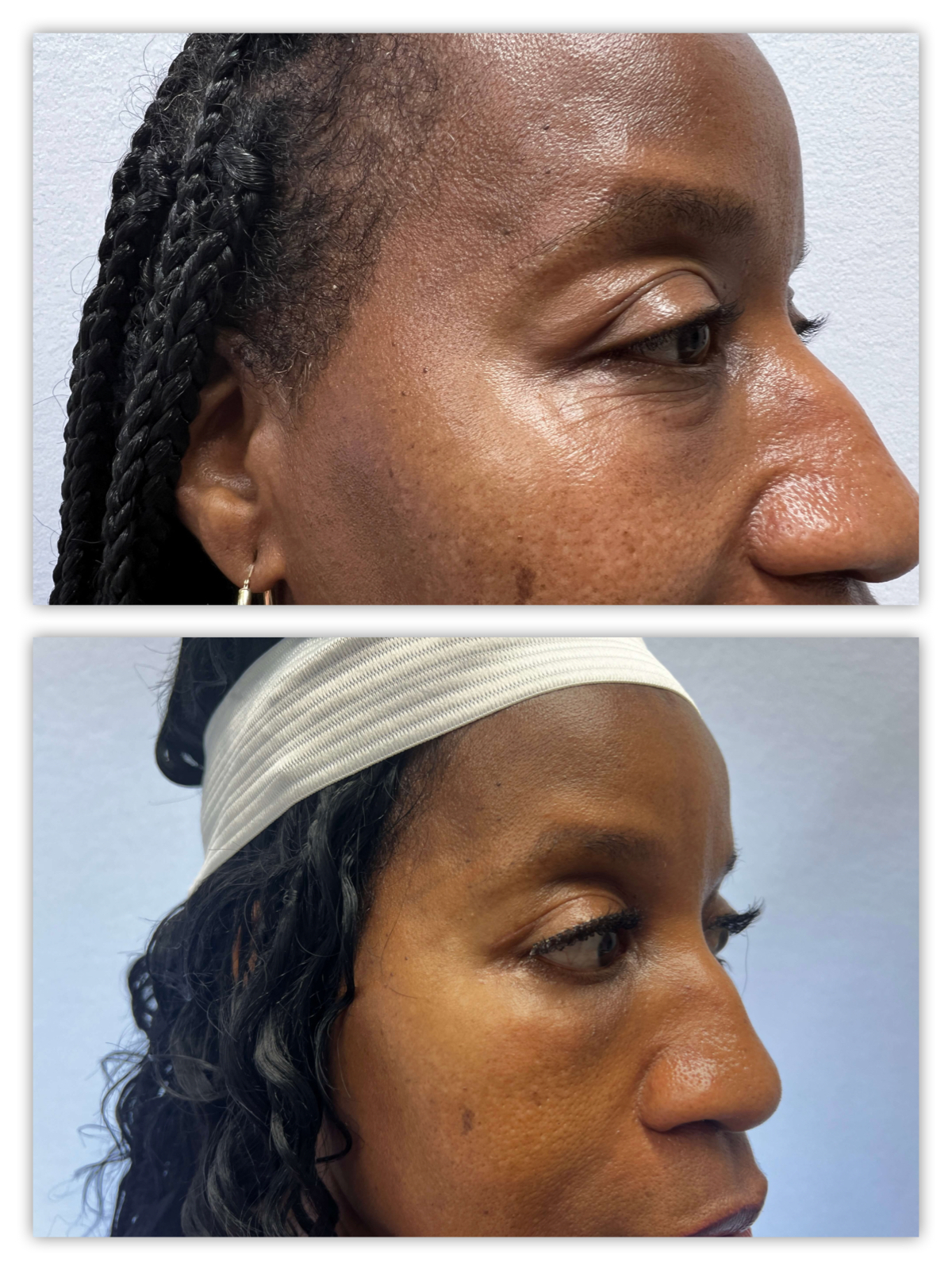 Before and After Image