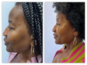 Before and After Image