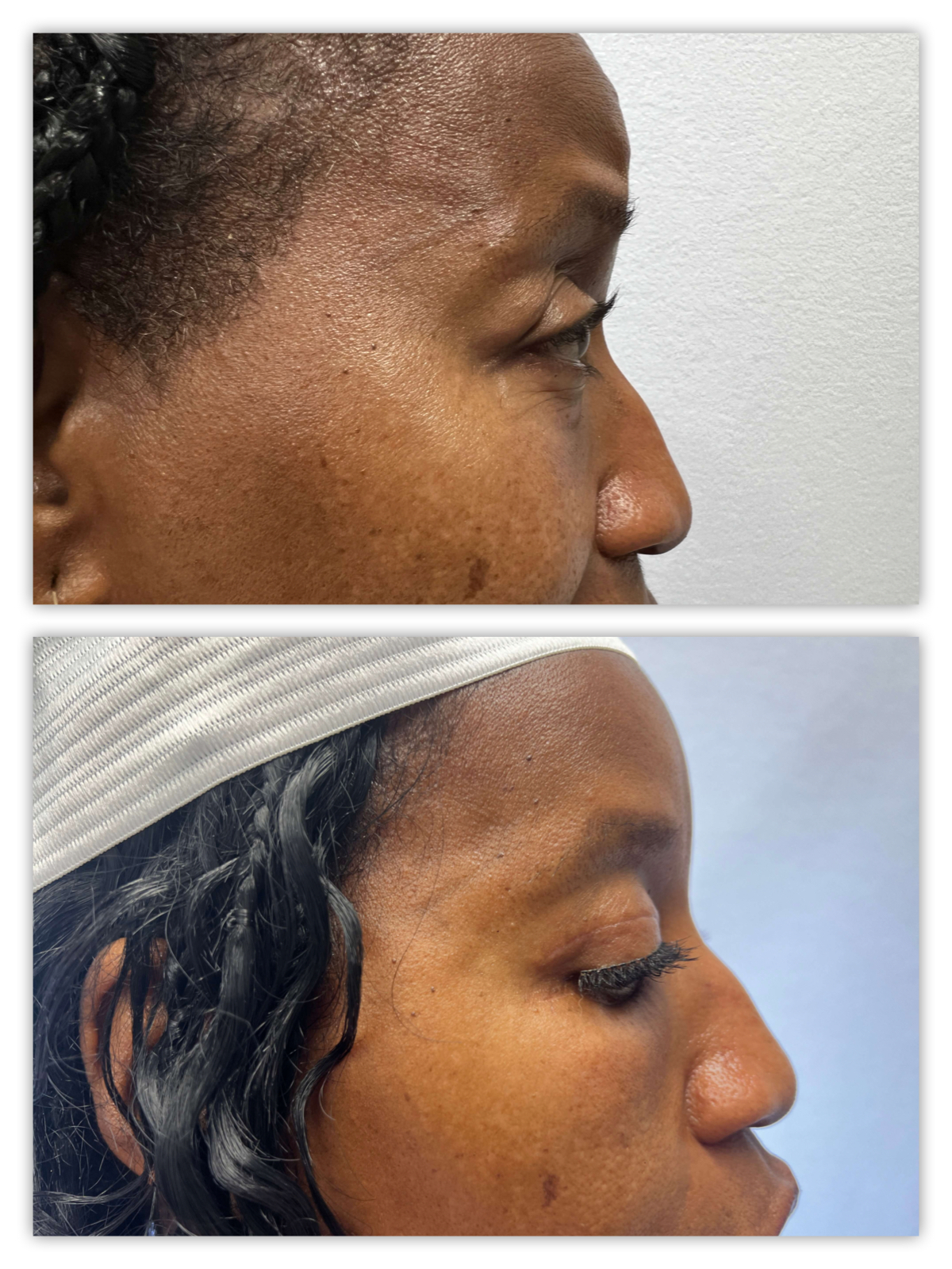 Before and After Image