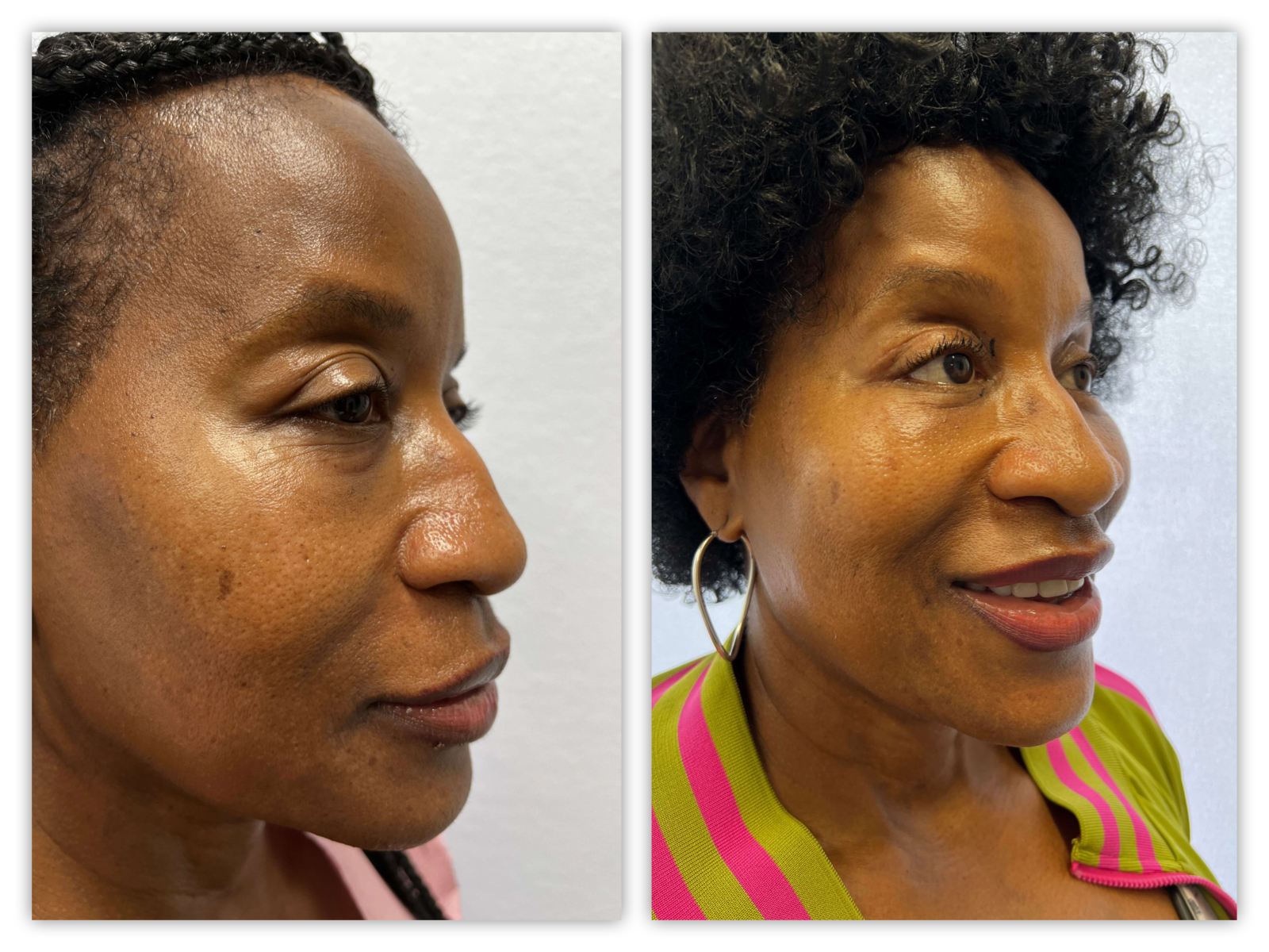 Before and After Image