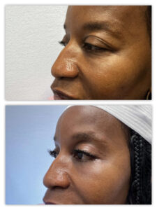 Before and After Image