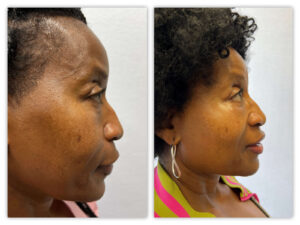 Before and After Image