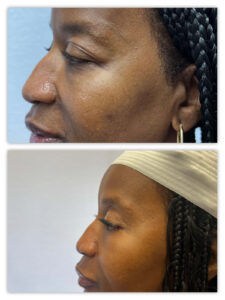 Before and After Image