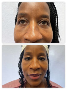 Before and After Image