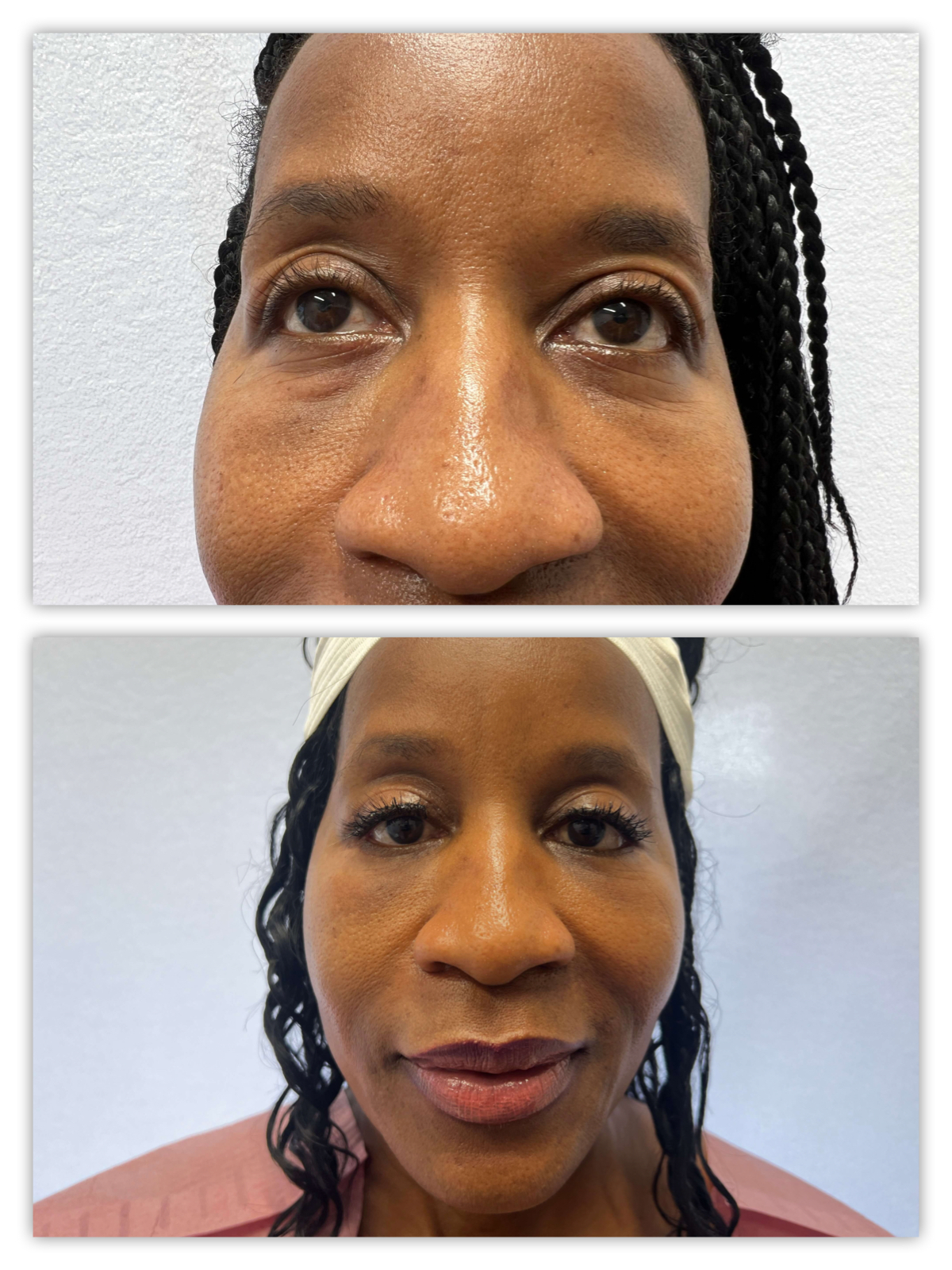 Before and After Image