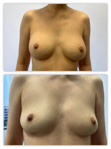 Before and After Image