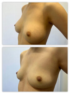 Before and After Image