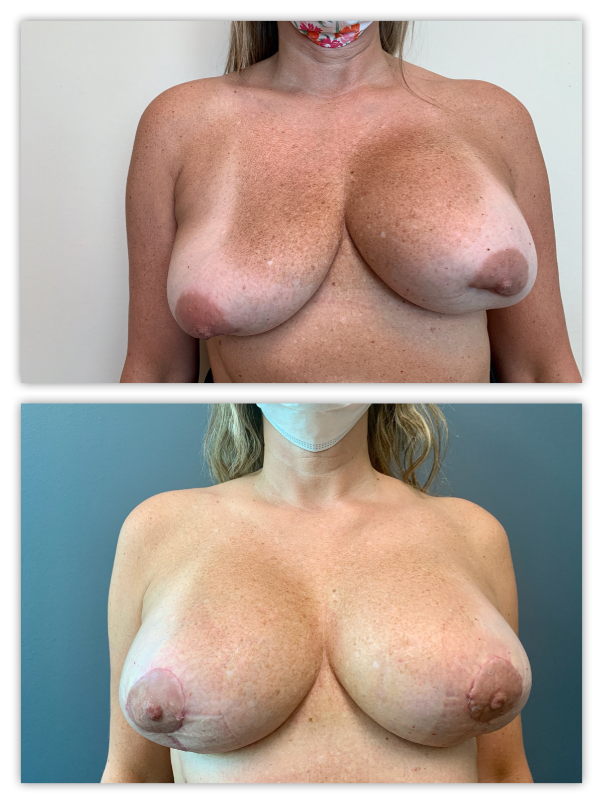 Before and After Image