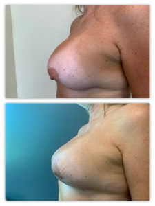 Before and After Image