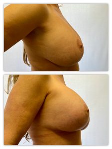 Before and After Image