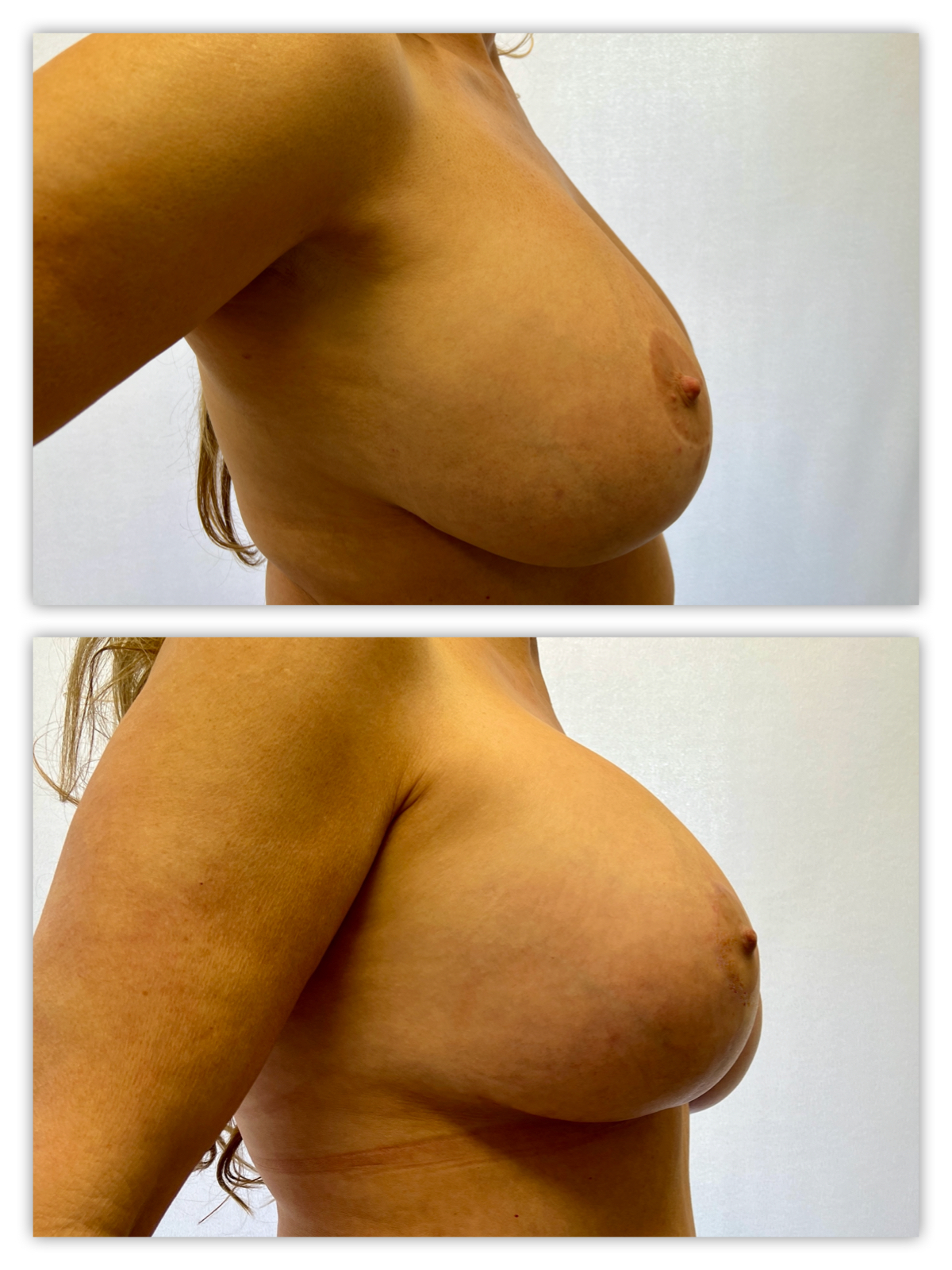 Before and After Image