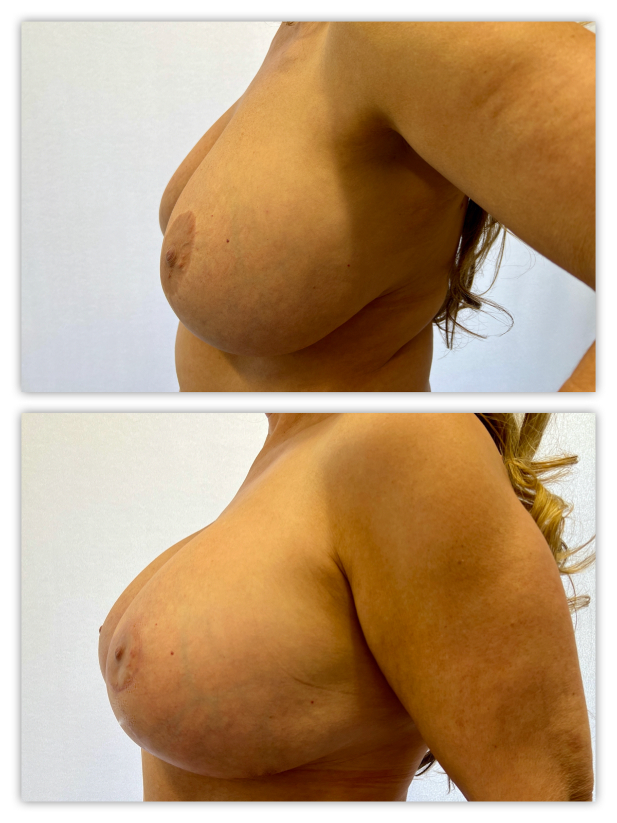 Before and After Image