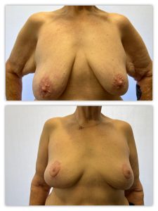 Before and After Image