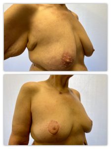 Before and After Image