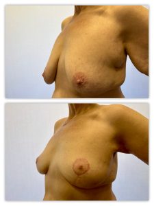 Before and After Image