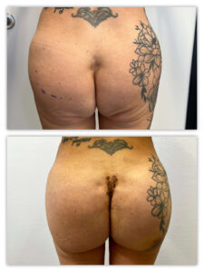 Before and After Image
