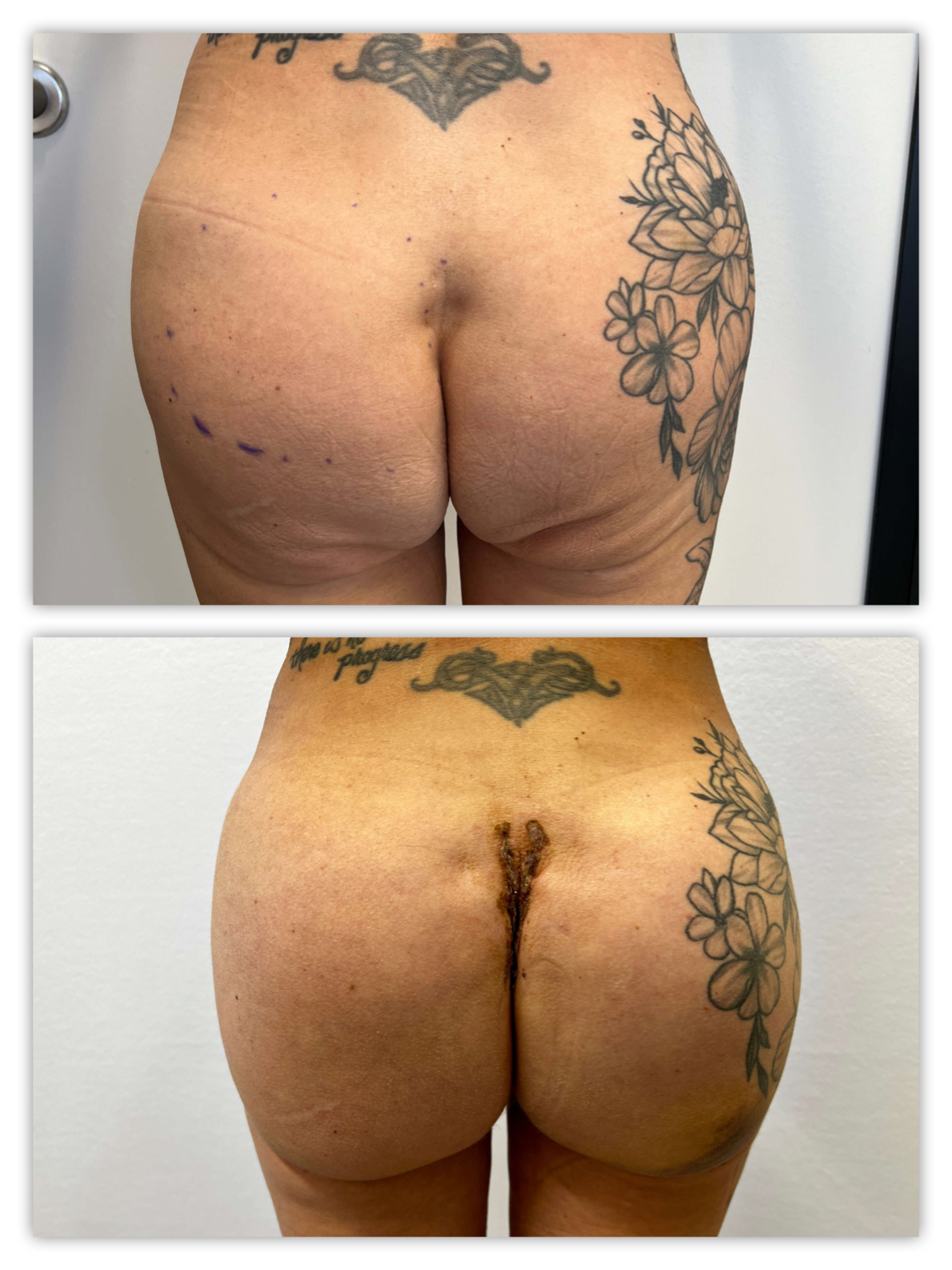 Before and After Image