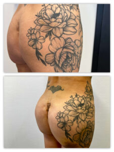 Before and After Image
