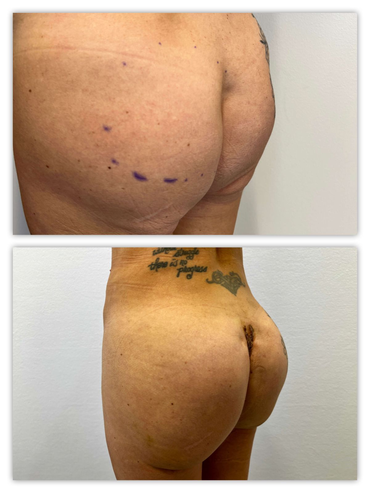Before and After Image