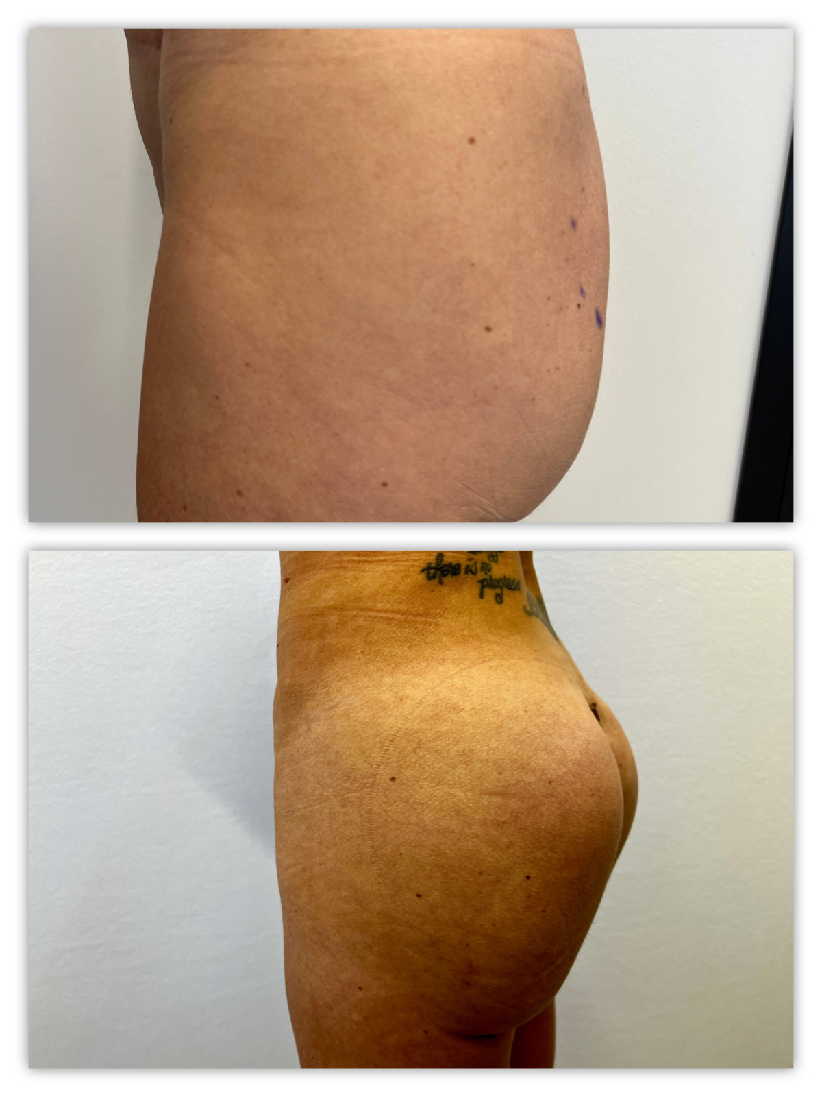 Before and After Image