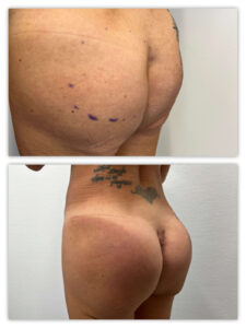 Before and After Image