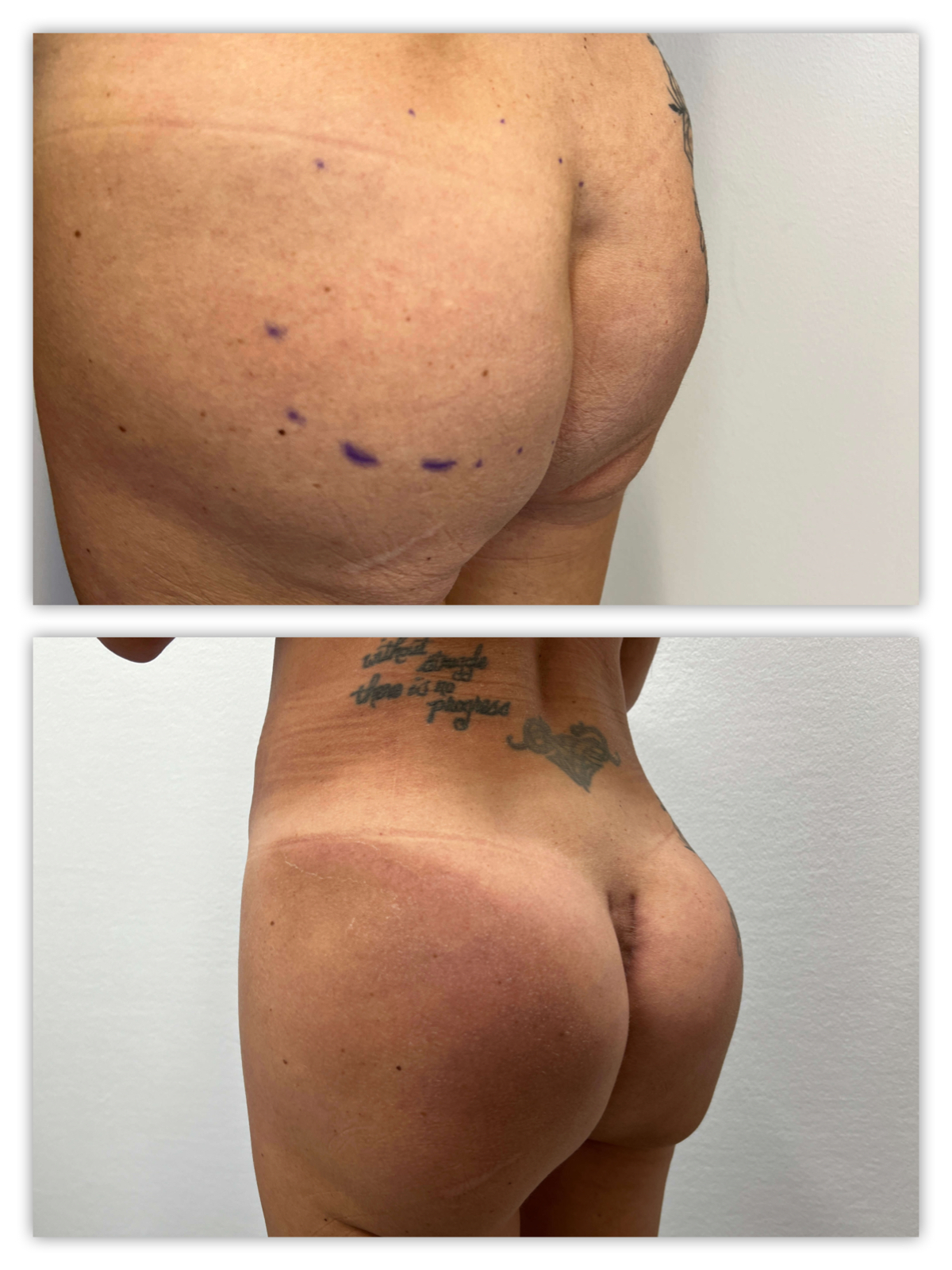 Before and After Image