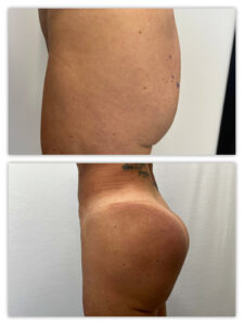 Before and After Image