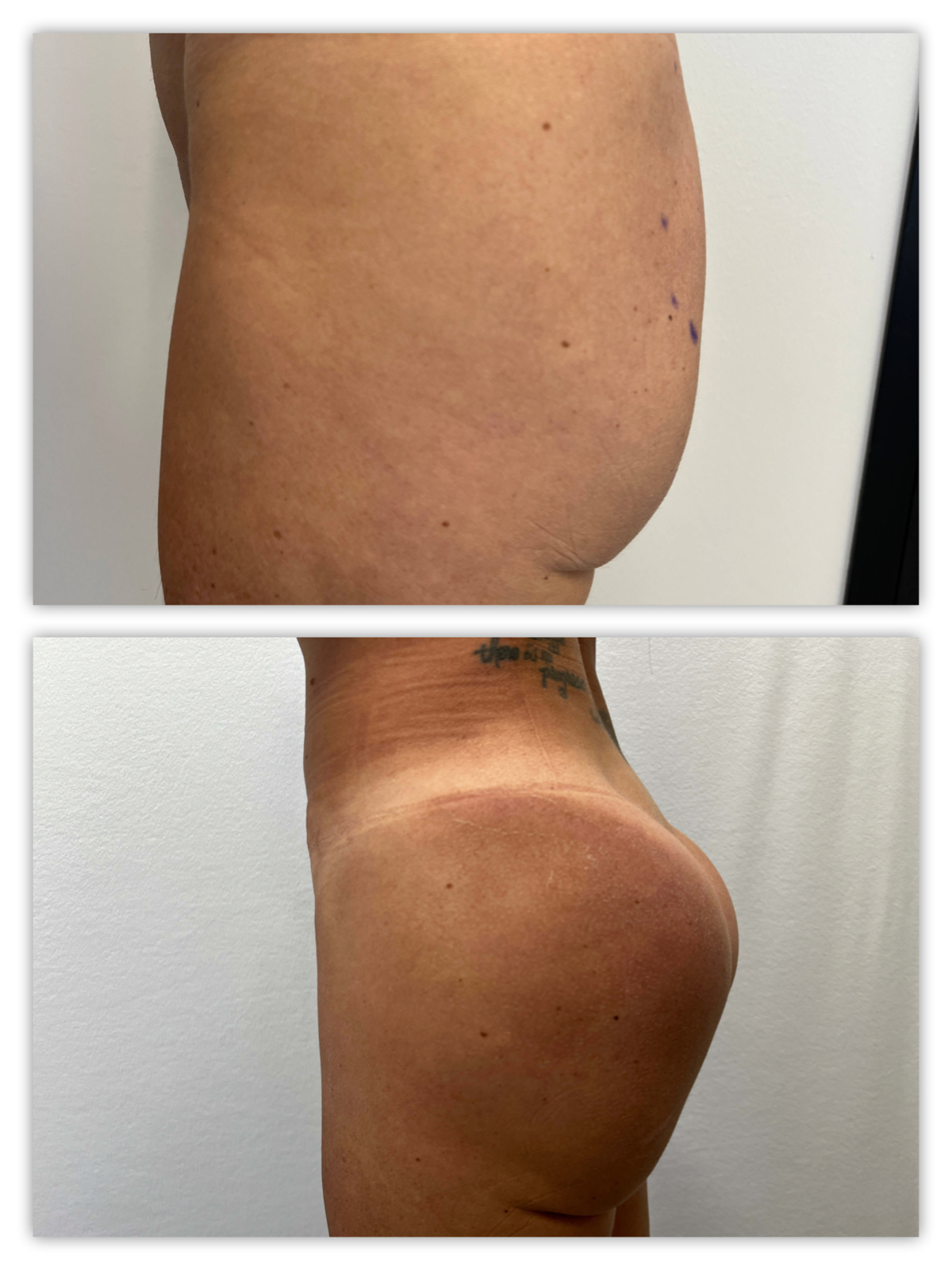 Before and After Image