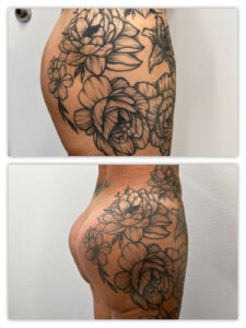 Before and After Image