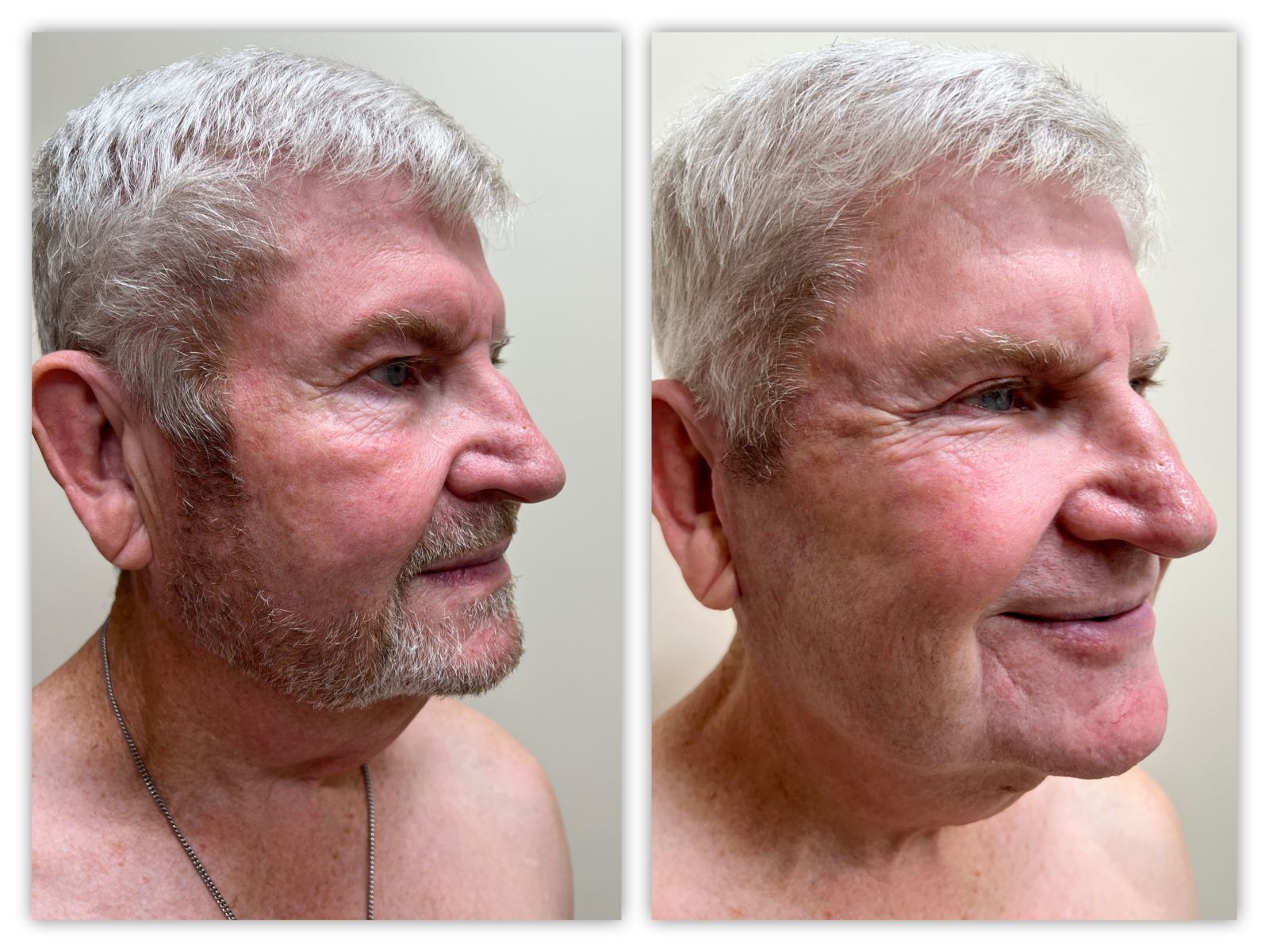 Before and After Image