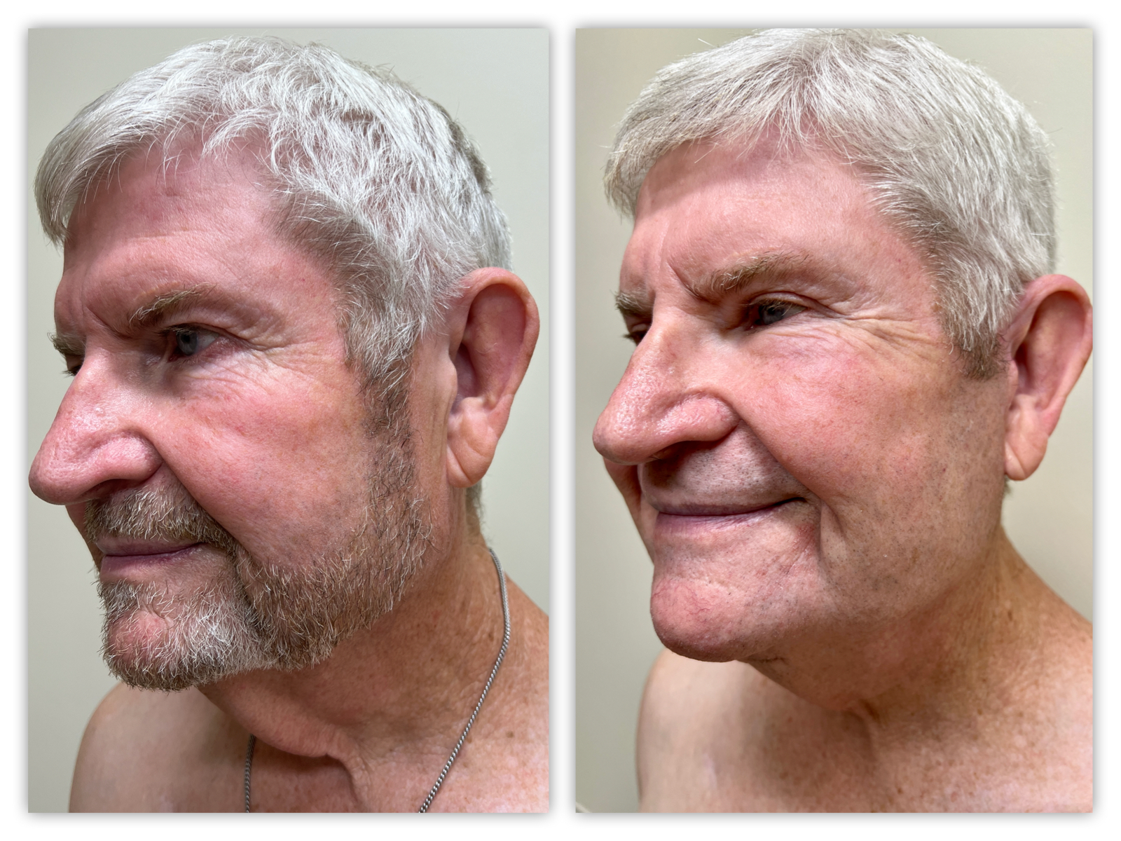 Before and After Image