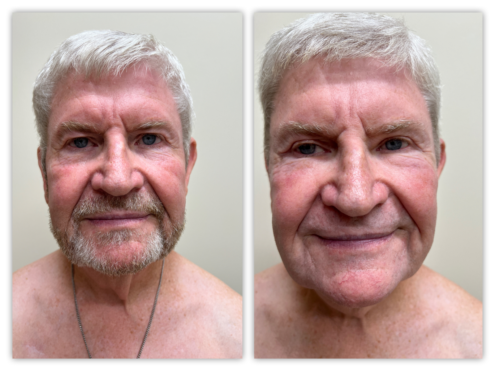 Before and After Image