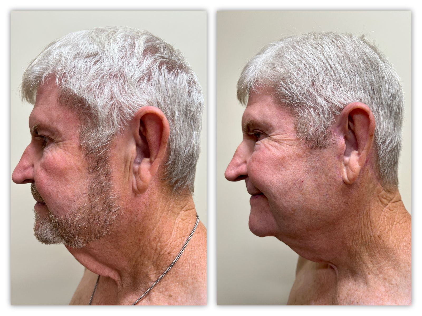 Before and After Image