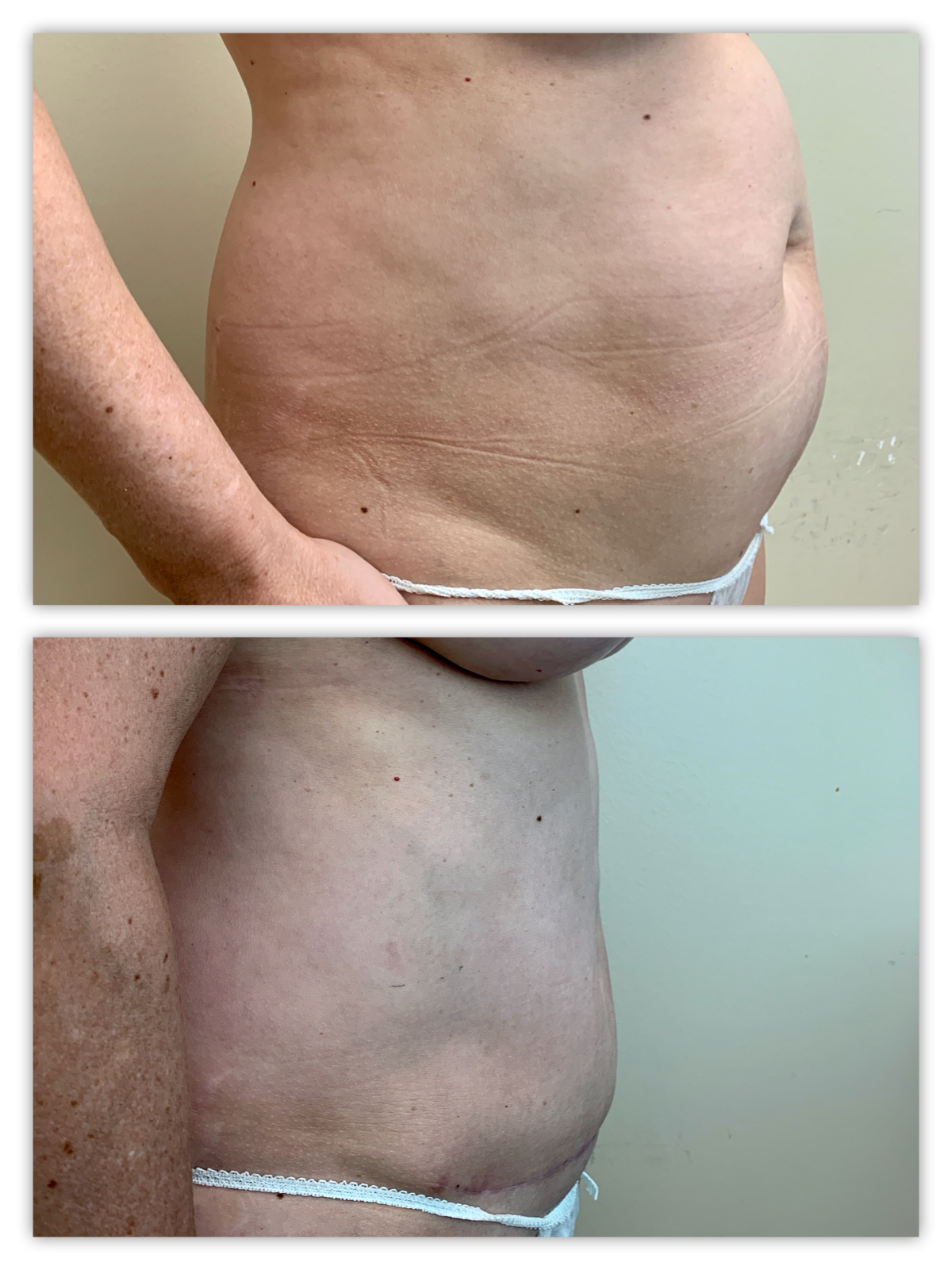 Before and After Image