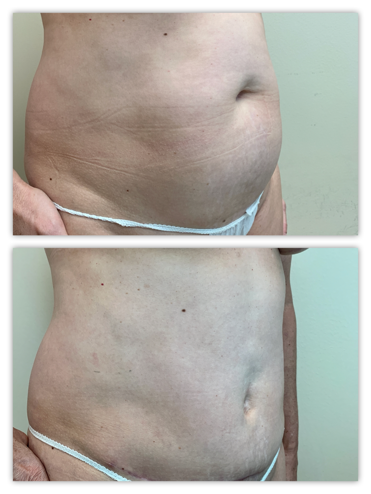 Before and After Image