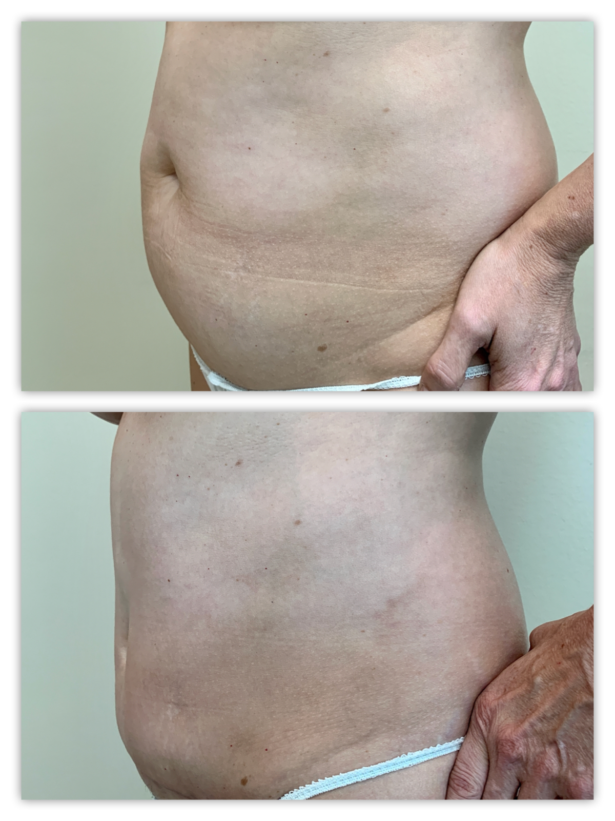 Before and After Image