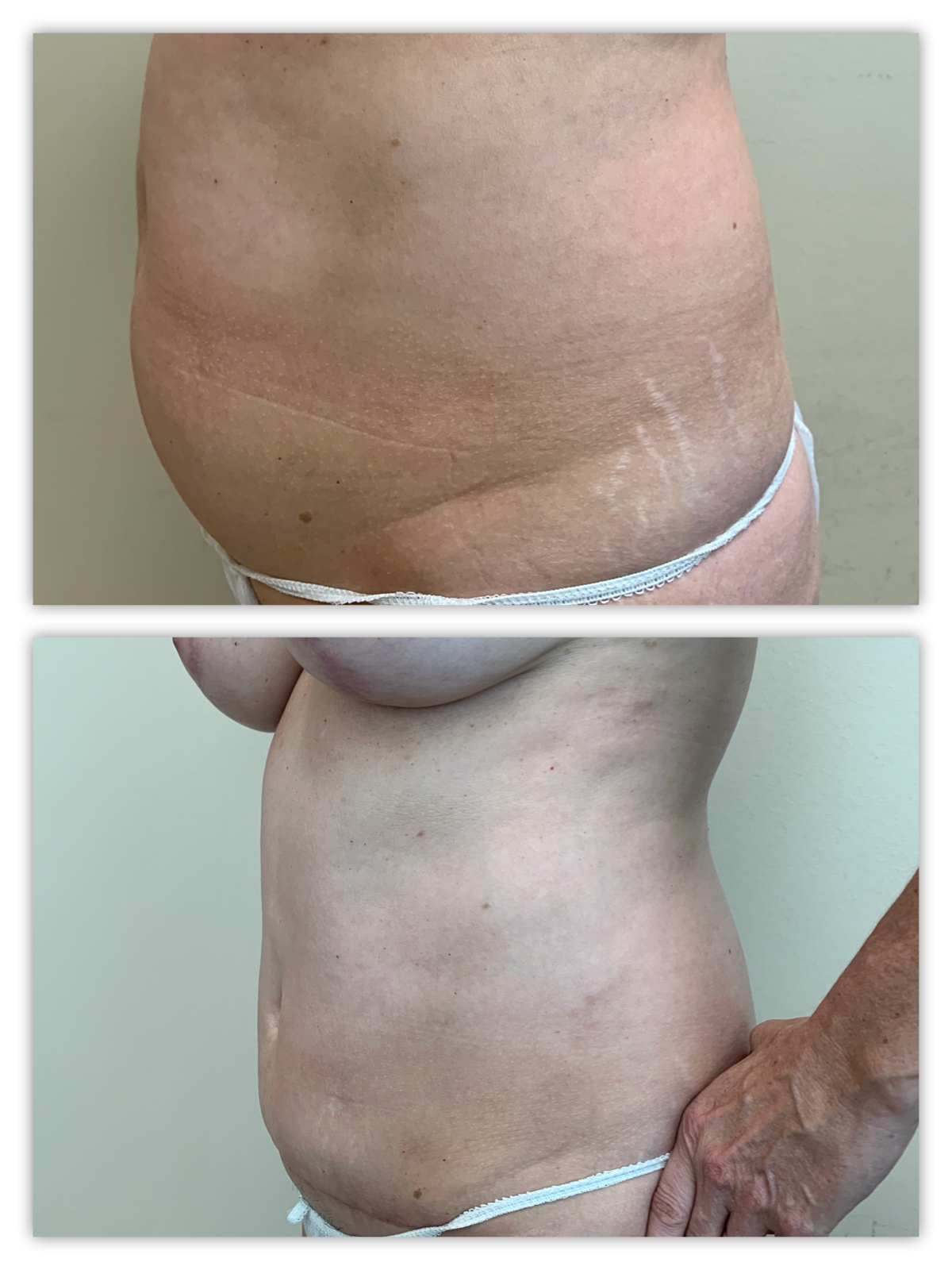 Before and After Image