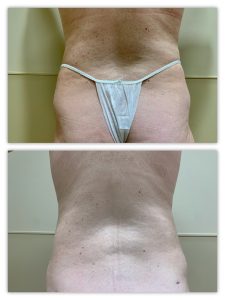 Before and After Image