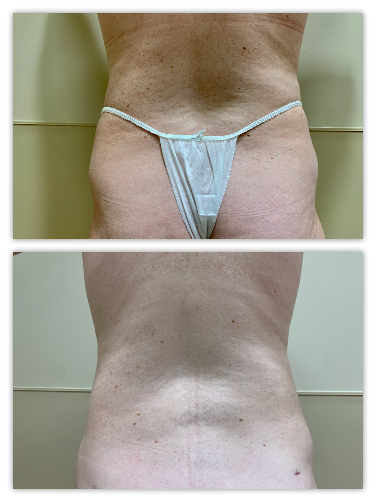 Before and After Image