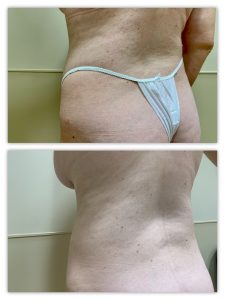 Before and After Image