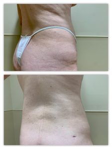 Before and After Image
