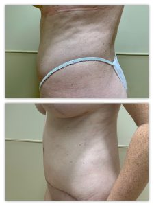 Before and After Image