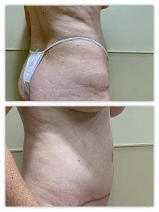 Before and After Image